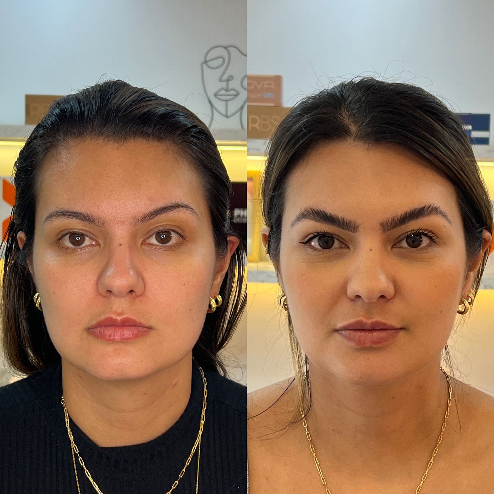 Resultado 2 do Up Gluteo